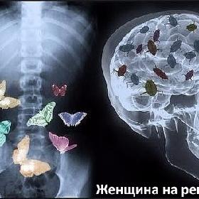 Женщина на рентгене